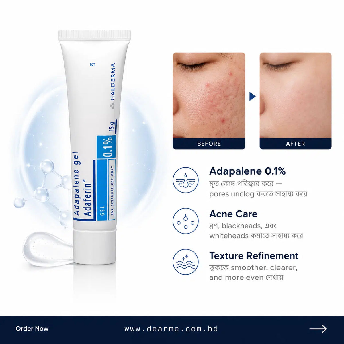 Adapalene Gel 0.1% Adaferin