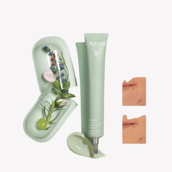 Caudalie – Vinopure,Stop Boutons Salicylique