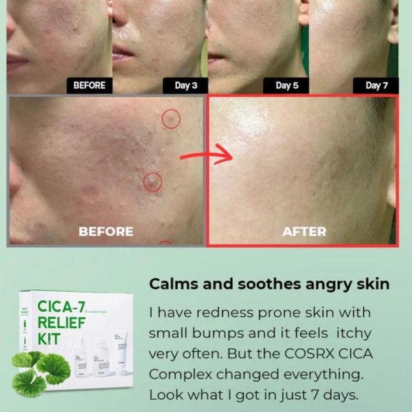 COSRX Promo Set – PURE CICA Relief Kit