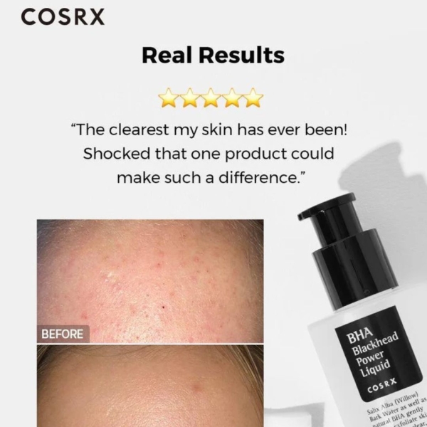 BHA Blackhead Power Liquid