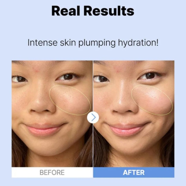 The Hyaluronic Acid 3